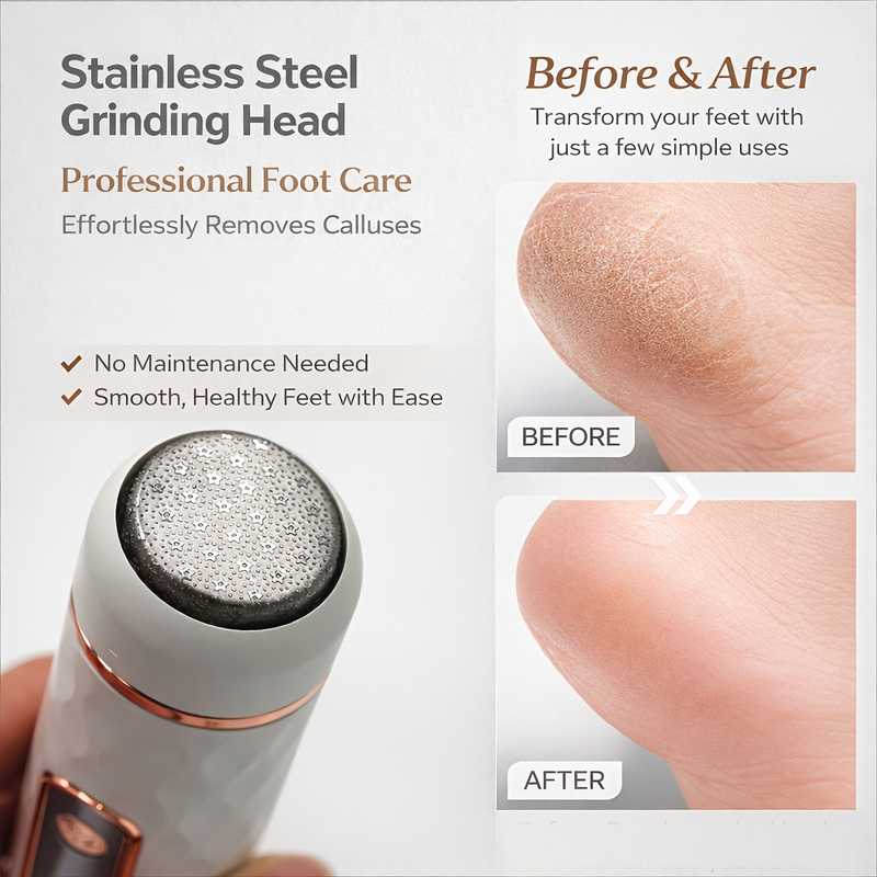 Rechargeable Electric Heel Callus Remover