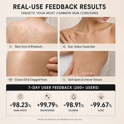 🛁 Niacinamide Skin Brightening Soap melasma dark spots freckle